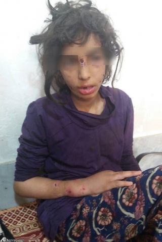 جزئیات شکنجه 3 کودک در ماهشهر با چکش و میله داغ