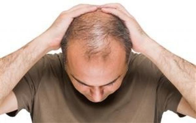 روشهای طب سنتی برای جلوگیری از ریزش مو