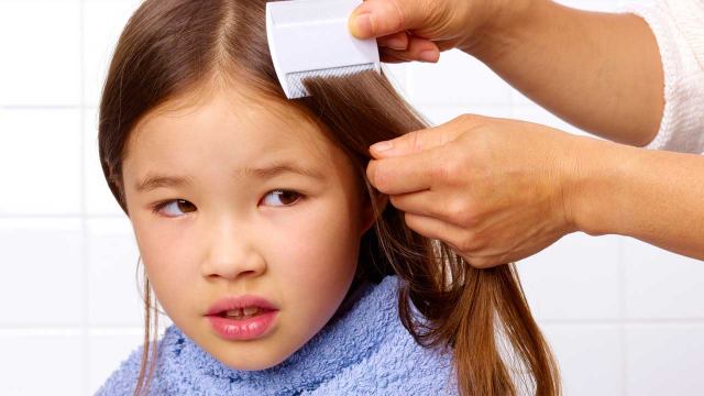 راهکارهای اشتباه درمان شپش سر کودکان
