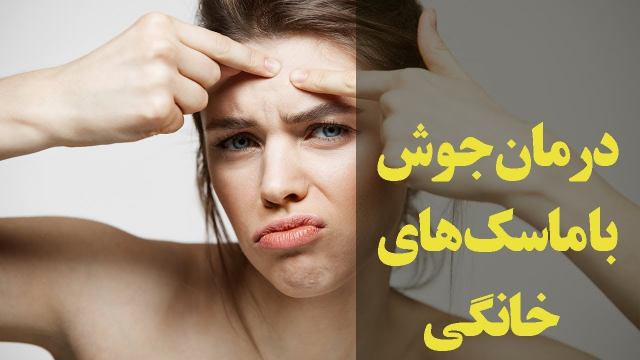 درمان جوش با ماسک های خانگی