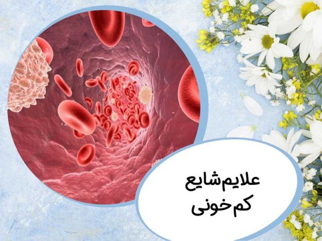 علایم شایع کمخونی در افراد که شاید ندانید !!!