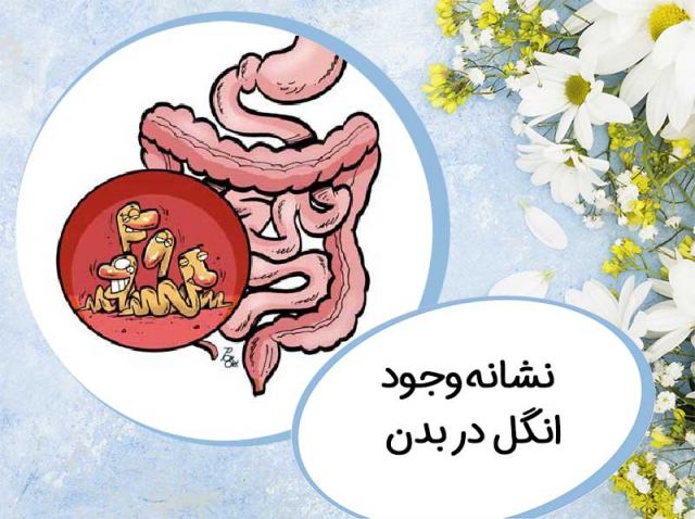 نشانه های وجود انگل در بدن را بشناسید