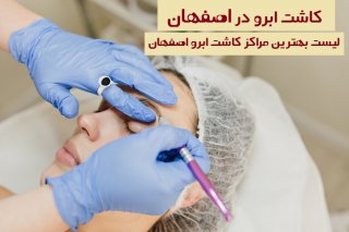 برای پیوند ابرو در اصفهان به کجا مراجعه کنم؟