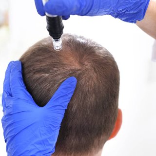آیا درمان ریزش مو ممکن است؟
