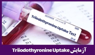 آزمایش هورمون تی تری uptake تیروئید/ Triiodothyronine Uptake (T3 UP)
