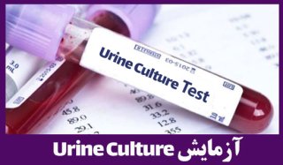 آزمایش کشت ادرار / Urine Culture (U/C)