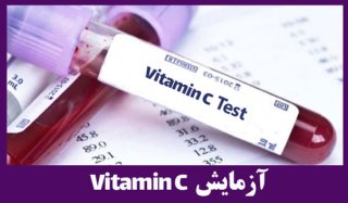 آزمایش ویتامین C (اسید اسکوربیک) /Vitamin C (Vit C)