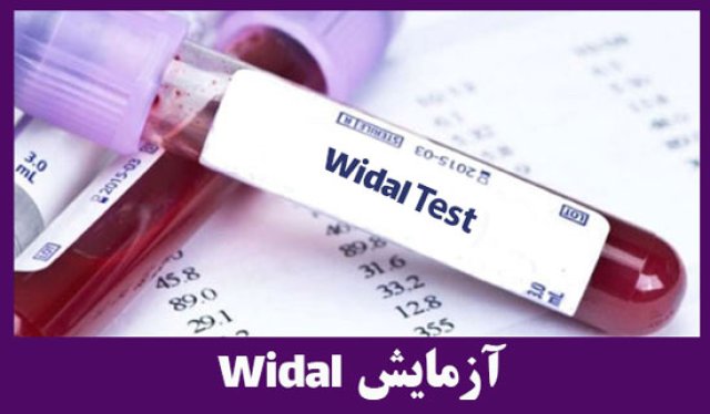 آزمایش ویدال / Widal