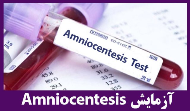 آزمایش آمنیوسنتز / Amniocentesis