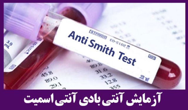 آزمایش آنتی بادی آنتی اسمیت / (Anti SM)