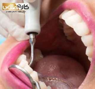 عفونت دندان چیست؟+درمان ان