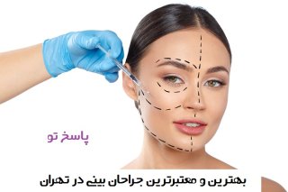 جراحی پر طرفدار بینی و شیوه های مرسوم و جدید آن