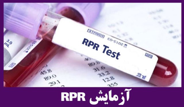 آزمایش آر پی آر/RPR (VDRL)