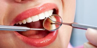 یسنا دنت: بزرگترین تولید کننده انواع وسایل دندانپزشکی