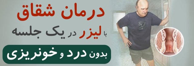 درمان شقاق با لیزر “راه قطعی”