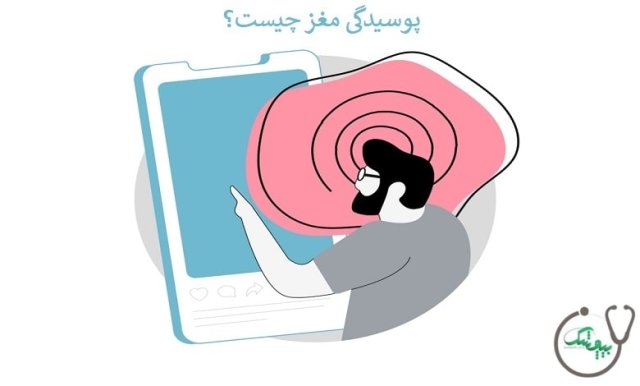 معنی پوسیدگی مغز "واژه 2024 آکسفورد" و تاثیرات آن