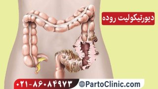 دیورتیکولیت + دارو و آنتی بیوتیک مناسب برای درمان قطعی