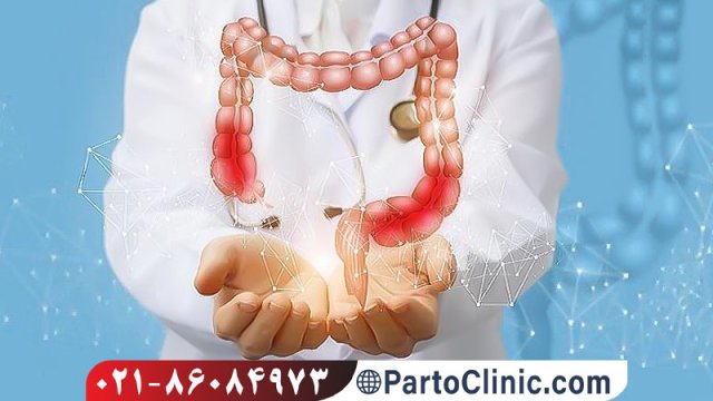 چگونه می توان از بیماری التهابی روده (IBD) پیشگیری نمود؟
