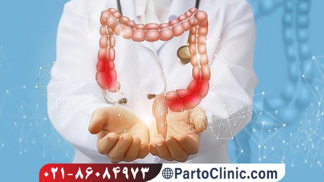 چگونه می توان از بیماری التهابی روده (IBD) پیشگیری نمود؟