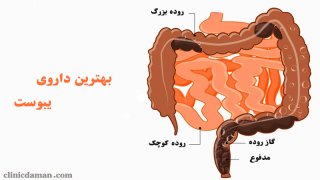 برای درمان سریع یبوست چی بخوریم؟