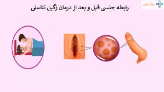 آیا با وجود زگیل تناسلی میتوان رابطه داشت؟