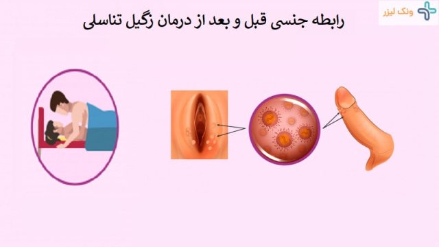 آیا با وجود زگیل تناسلی میتوان رابطه داشت؟