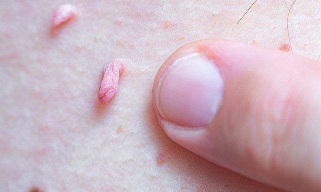 نکته هاي مهم در انتخاب پزشک متخصص ضايعه هاي پوستي