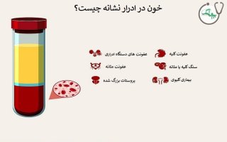 علل رایج وجود خون در ادرار (هماچوری)