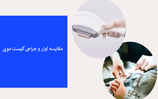 برای درمان کیست مویی چه روشی بهتر است؟ (جراحی یا لیزر)