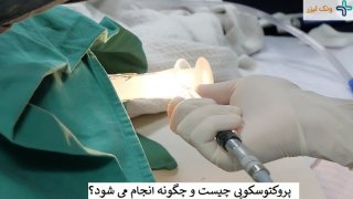 پروکتوسکوپی چیست و چگونه انجام می شود؟