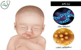 زرد زخم چیست؟ {روشهای درمان آن}