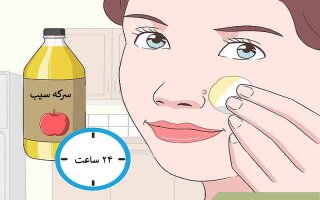 چه روشهایی برای درمان زگیل صورت وجود دارد؟