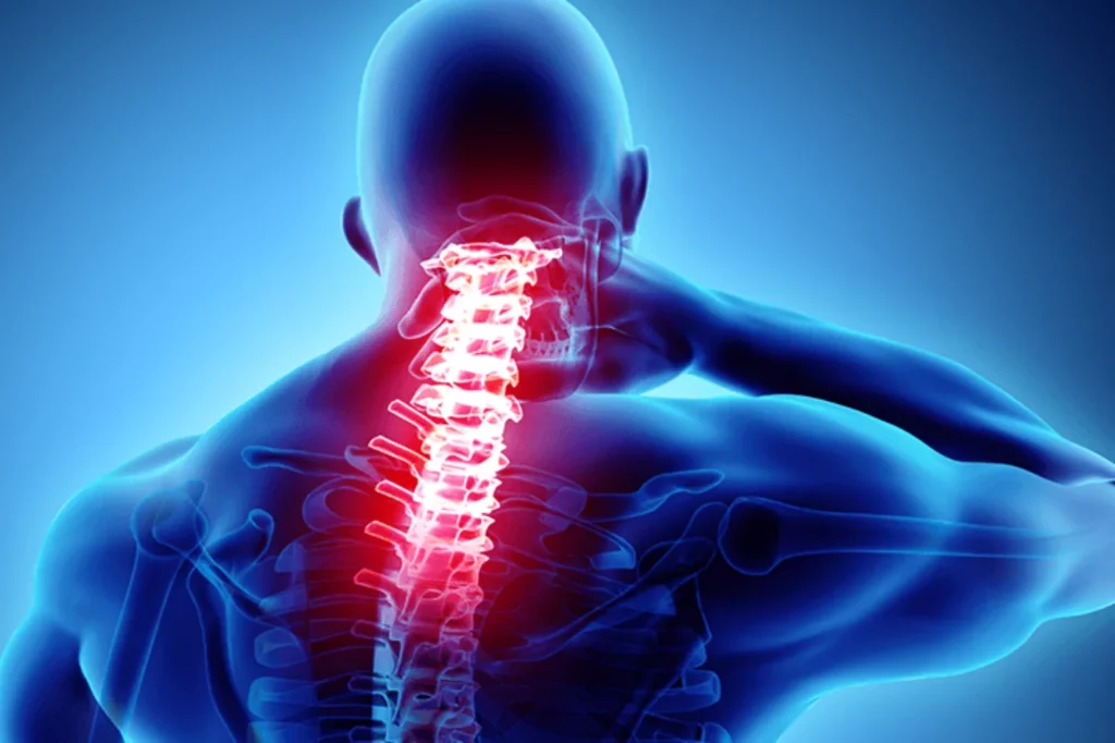 علائم دیسک گردن