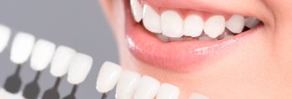 کامپوزیت بهتر است یا لمینت؟ بررسی کامل برای انتخاب بهتر