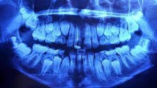 مضرات و خطرات اشعه ایکس در دندانپزشکی