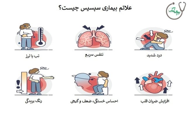 سپسیس چیست و چگونه درمان میشود؟