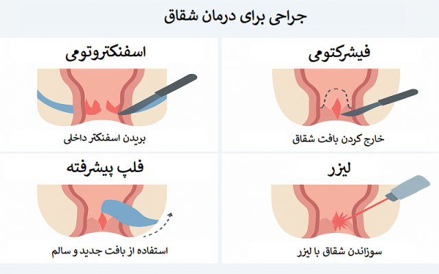 آیا اگر شقاق را درمان نکنیم ممکن است از بین برود؟