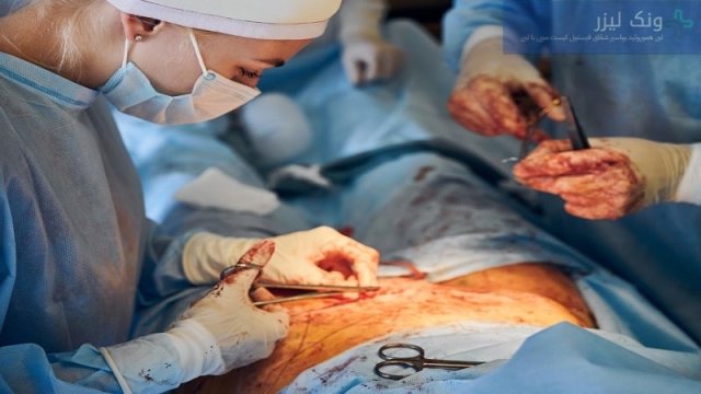 بررسی 4 روش رایج عمل جراحی کیست مویی