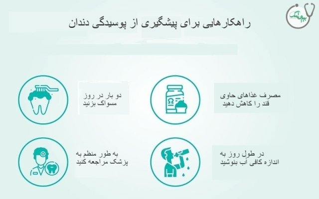 چه غذاهایی برای جلوگیری از پوسیدگی دندان مفید هستند؟