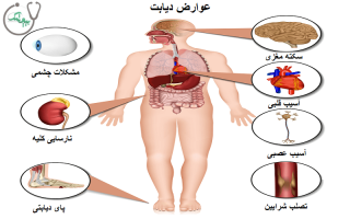 دیابت چه عوارضی دارد؟