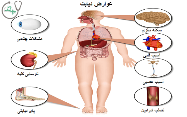 دیابت چه عوارضی دارد؟