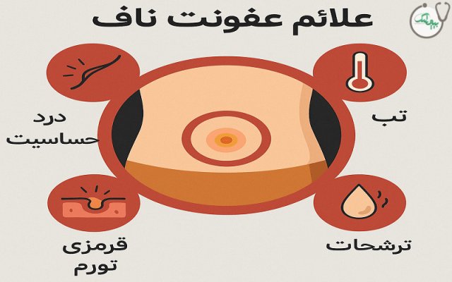 برای درمان عفونت ناف از چه آنتی بیوتیکی استفاده کنیم؟