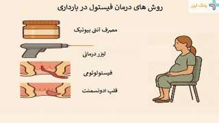 چگونه فیستول مقعدی را در بارداری درمان کنیم؟