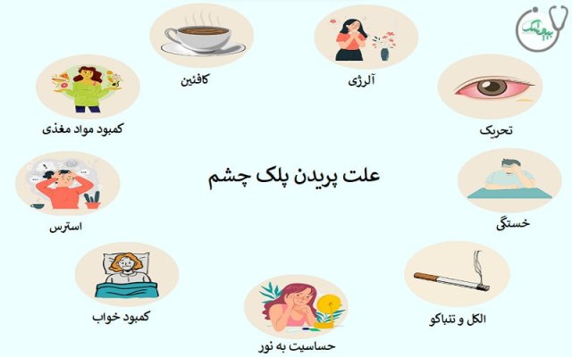 علت پرش پلک راست و چپ چشم چیست؟