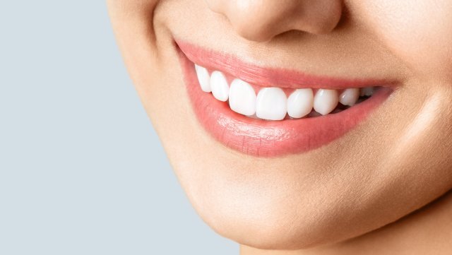 زیبایی لبخند با خدمات دندانپزشک زیبایی غرب تهران