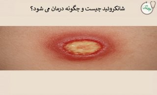 بیماری شانکروئید چیست و چگونه درمان می شود؟