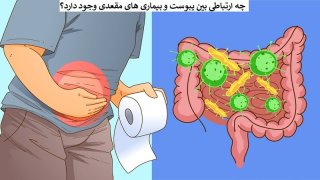 آیا یبوست باعث بیماری مقعدی می شود؟