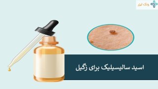 اسید سالیسیلیک برای زگیل تناسلی و عوارض آن