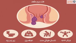 علت ورم خارج و داخل مقعد