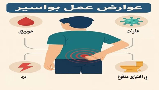 10 عوارض جانبی بواسیر